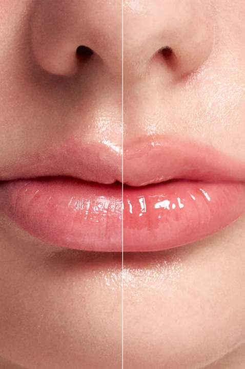 Intense lip plumper with microneedles Reedle Shot Lip Plumper Expert, 4,3 gIVET.HU - A te online butikod.