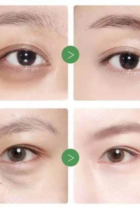 Mary&May Tranexamic Acid + Glutathion Eye Cream, 30 gIVET.HU - A te online butikod.